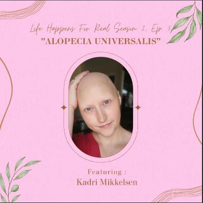 Alopecia Universalis- Complete loss of hair on the scalp and the body. Alopecia Universalis- Complete loss of hair on the scalp and the body.