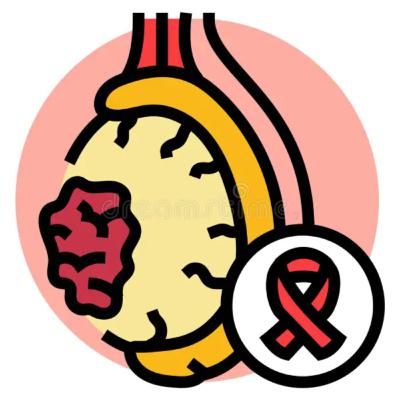 Men's Health - Part 4: Testicular Cancer: Etiology, Diagnosis, and Management