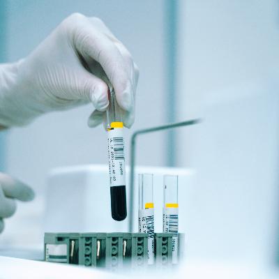 Tumor Lysis Syndrome