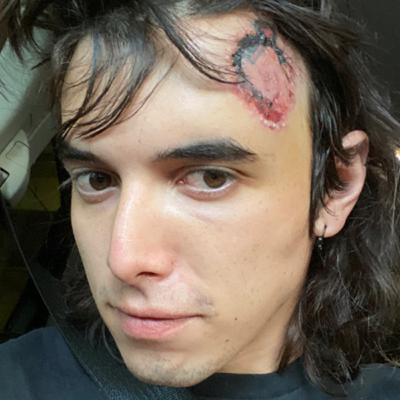 “Non-lethal” Police Tools