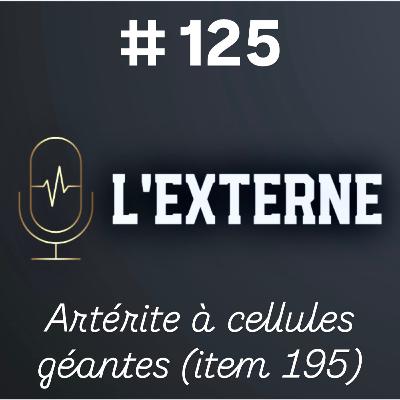 Episode 125 - Artérite à cellules géantes (item 195) Episode 125 - Artérite à cellules géantes (item 195)