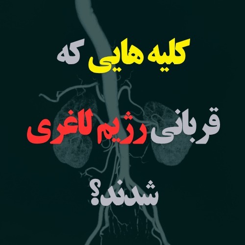 !کلیه هایی که قربانی رژیم لاغری شدند