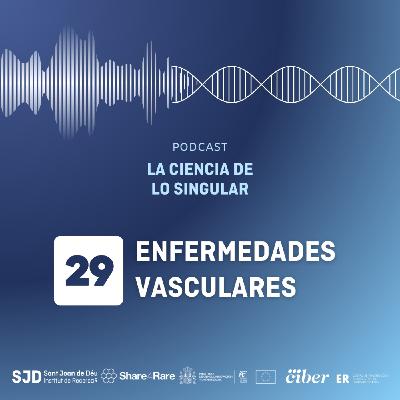 Enfermedades vasculares | La Ciencia de lo Singular Enfermedades vasculares | La Ciencia de lo Singular