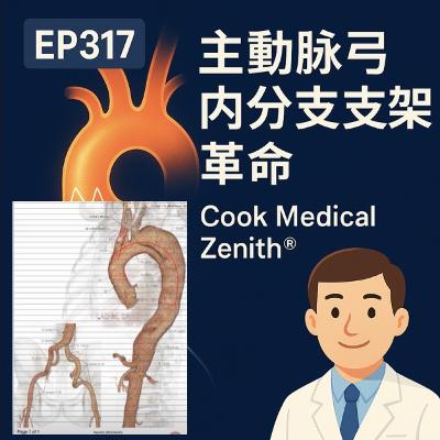 🎙️EP317|COOK Zenith® 客製化主動脈弓支架系統 🎙️EP317|COOK Zenith® 客製化主動脈弓支架系統