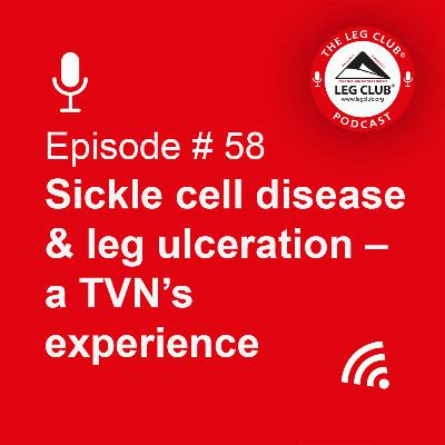 Sickle cell disease & leg ulceration - a TVN's experience