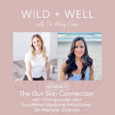 Episode 71 - The Gut-Skin Connection with Chiropractor and Functional Medicine Practitioner Dr Michelle Solomon Episode 71 - The Gut-Skin Connection with Chiropractor and Functional Medicine Practitioner Dr Michelle Solomon