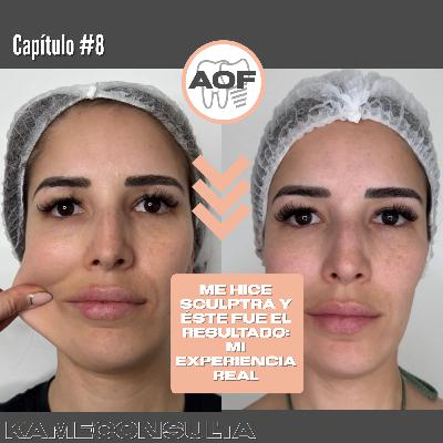 Capitulo 8: Me hice SCULPTRA y ESTE fue el resultado: Mi experiencia real Capitulo 8: Me hice SCULPTRA y ESTE fue el resultado: Mi experiencia real