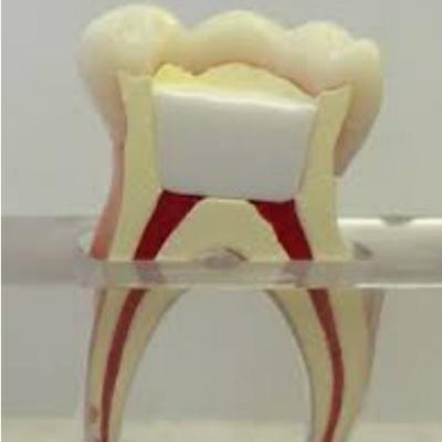 Pré-aula 12 - medicamentos utilizados na pulpotomia de dentes decíduos