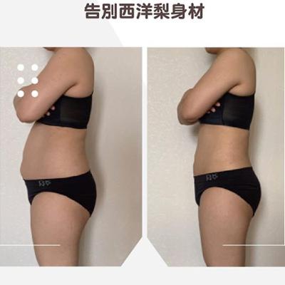 EP28 [抽脂懶人包］每個地方都可以抽脂嗎？最常見，跟最特殊的抽脂部位在哪兒呢？