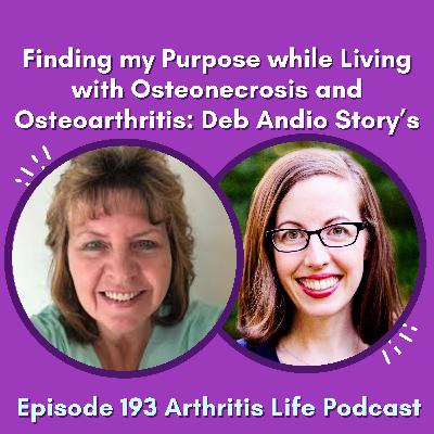 Finding my Purpose while Living with Osteonecrosis and Osteoarthritis: Deb Andio’s Story