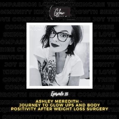 Episode 35: With Ashley Meredith - Journey to Glow Ups & Body Positivity After Weight Loss Surgery