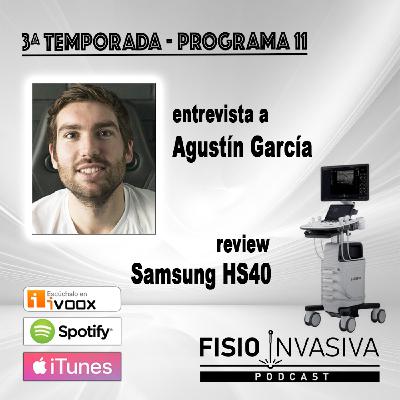 FISIOTERAPIA INVASIVA T3x11 AGUSTÍN GARCíA