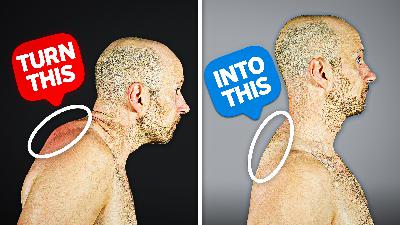 Fix Your Neck Hump FAST (10 Minutes a Day) Fix Your Neck Hump FAST (10 Minutes a Day)