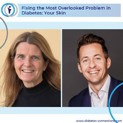 Fixing the Most Overlooked Problem in Diabetes: Your Skin Fixing the Most Overlooked Problem in Diabetes: Your Skin