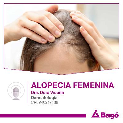 ALOPECIA FEMENINA