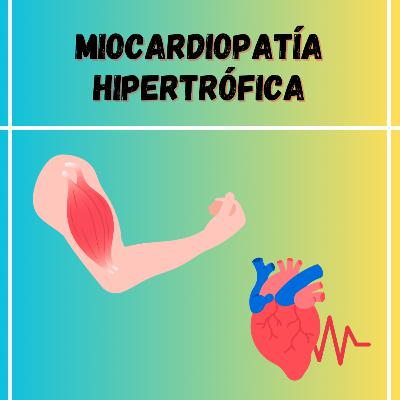 Capítulo 160: Miocardiopatía Hipertrofia