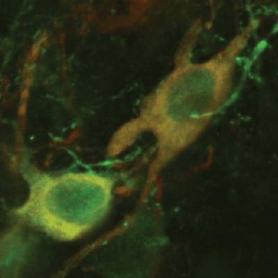Earliest Signs of Parkinson's Disease with D. James Surmeier, PhD