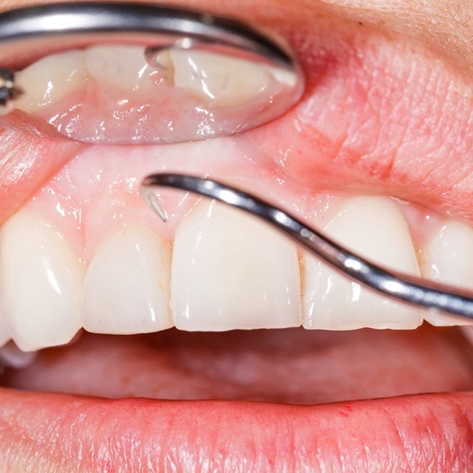 What Kind of Procedures Does a Periodontist Perform