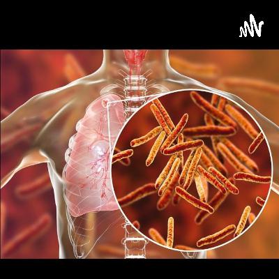 TUBERCULOSE