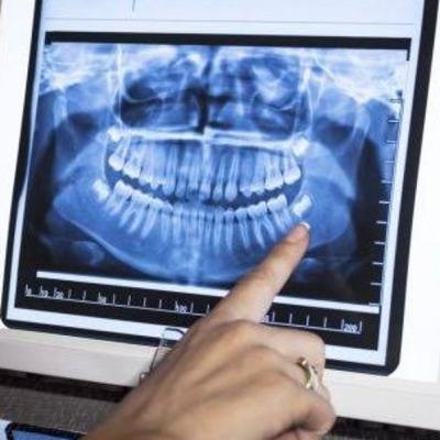 Resumo do artigo: Radiografia digital