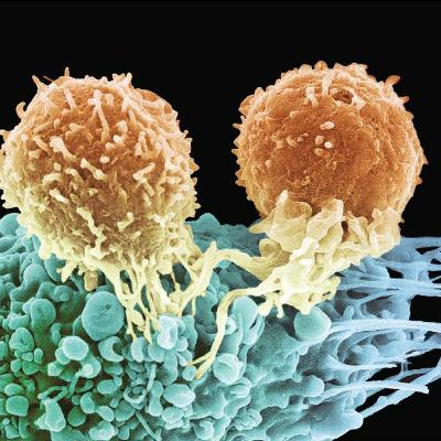 Effector Responses: Antibody- and Cell Mediated Immunity( immunology part 12)