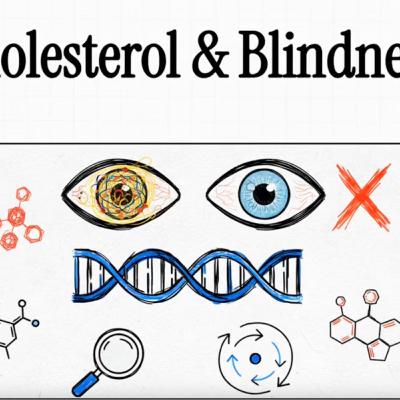 Can Lipids Impact Macular Degeneration? Here’s What Research Says