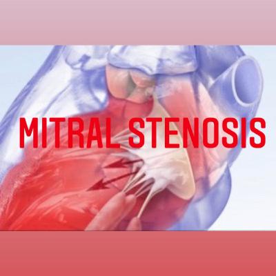 Mitral Stenosis Ep.3