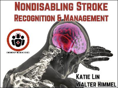 Ep 209 Nondisabling Stroke Recognition and Management