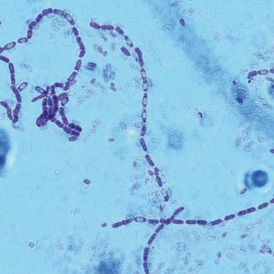 Major Shifts in Bacterial Transcription (CMB part 6) Major Shifts in Bacterial Transcription (CMB part 6)
