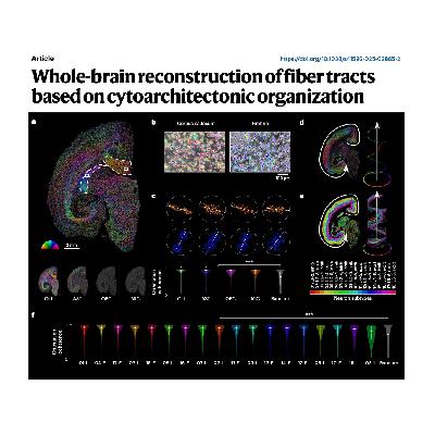 318-Whole-brain reconstruction of fiber tracts 318-Whole-brain reconstruction of fiber tracts