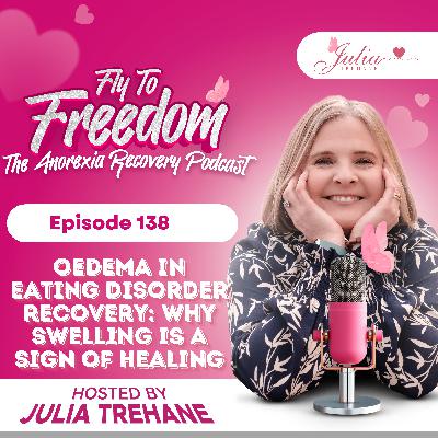 Episode 138 – Edema in Eating Disorder Recovery: Why Swelling Is a Sign of Healing