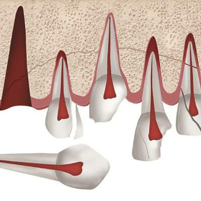 APRESENTAÇÃO DO CURSO "WORKFLOW EM URGÊNCIAS DOS TRAUMATISMOS DENTÁRIOS" APRESENTAÇÃO DO CURSO "WORKFLOW EM URGÊNCIAS DOS TRAUMATISMOS DENTÁRIOS"