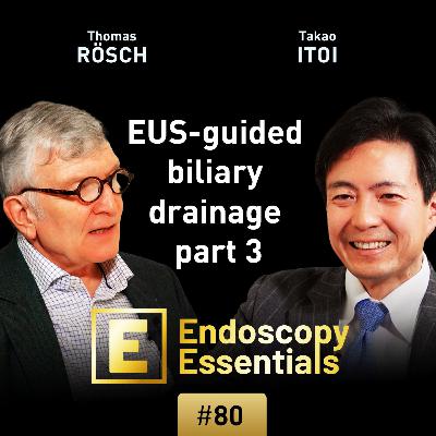 EUS-guided biliary drainage part 3