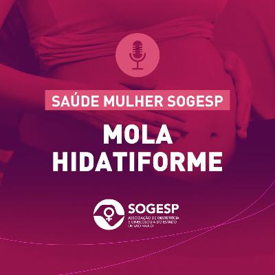 Mola Hidatiforme - Podcast Saúde Mulher SOGESP