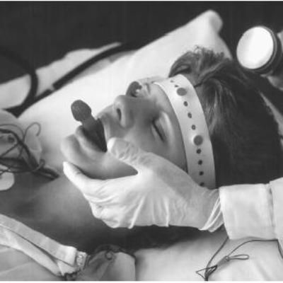 The true about Electroconvulsive Therapy! Peripartum Disorders + Grief + Drugs Side Effects