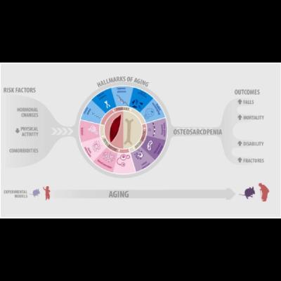 Deciphering Osteosarcopenia: Aging, Muscle Loss, and Bone Fragility