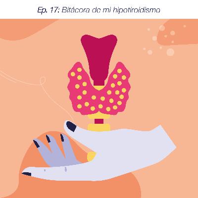 Ep. 17: Bitácora de un hipotiroidismo Ep. 17: Bitácora de un hipotiroidismo