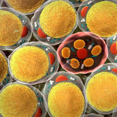 Can We Stop Fat From Fueling Triple-Negative Breast Cancer?