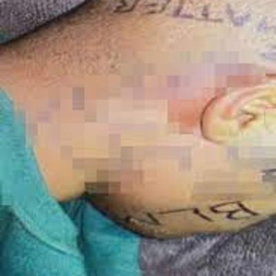 Here We Go: Monkeypox Hits