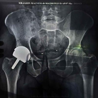 Tales from the Epic Machine: The end of my career (part 1)