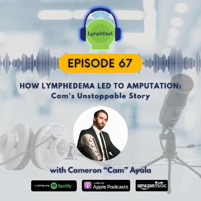How Lymphedema Led to Amputation: Cam's Unstoppable Story | LymphCast E67