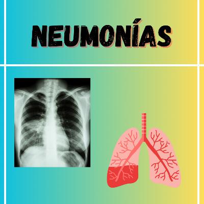 Capítulo 164: Neumonías