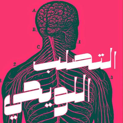 التصلب اللويحي التصلب اللويحي