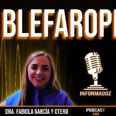 Blefaroplastia/Ep 88 /Informadoz by Tony Flores