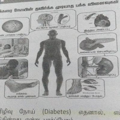 Diabetes and remedies in Tamil.