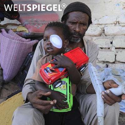 Bürgerkrieg im Sudan: die ignorierte Katastrophe