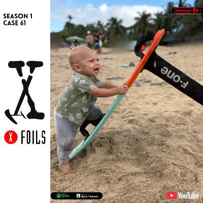 Case #61 – F-One’s Big Shift: New Connection, Better Feels Case #61 – F-One’s Big Shift: New Connection, Better Feels