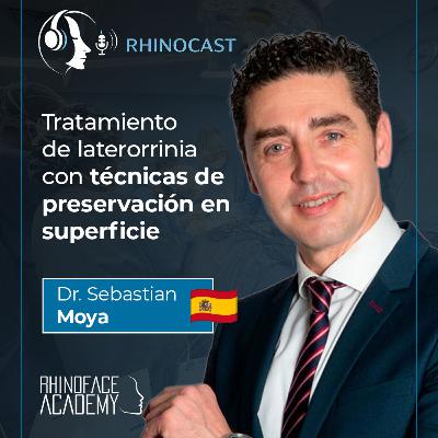 Como tratar a laterorrinia preservando estrutura, função e naturalidade | ⁠Dr. Sebastian Moya⁠ 🇪🇸