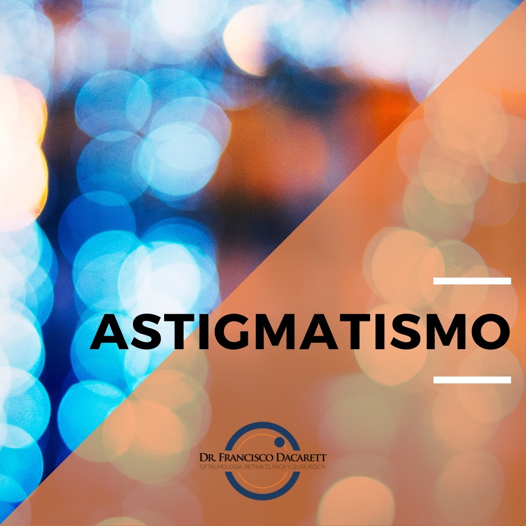 Ep 03 - Astigmatismo