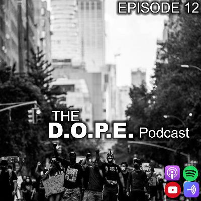 The DOPE Show Episode 12 | I Just Want To Live |